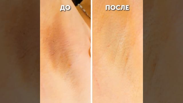 ЭТИ ЛАЙФХАКИ ОБЛЕГЧАТ УХОД ЗА КОЖЕЙ смотреть онлайн