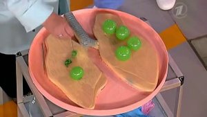 Пневмония. Что делать, чтобы легким легко дышалось