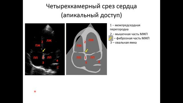 Ультразвуковая анатомия сердца