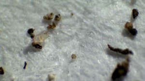 Клещ тирофагус в земле под микроскопом