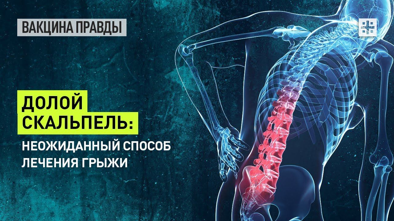 Долой скальпель: Неожиданный способ лечения грыжи