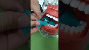 Тренировка постановки клампа с минирамкой Sowdan. Методика минидам.