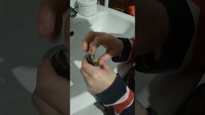 Укус красноухой черепахи