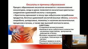 ПОЧКИ. Камни в почках. Заболевания мочевыделительной  системы