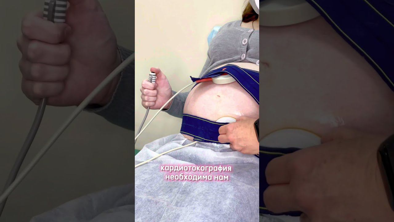 Кардиотокограмма смотреть онлайн