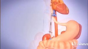 Трансплантация печени 3D.   Liver transplant 3D. Ghép gan 3D.