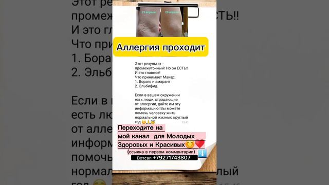 Аллергия проходит #сибирскоездоровье #борагоиамарант #бораго