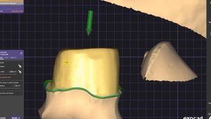 Одиночная коронка в exocad от А до Я. Спец выпуск.