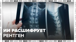 Собянин: в поликлиниках Москвы внедрят расшифровку рентген-исследований через ИИ - Москва 24