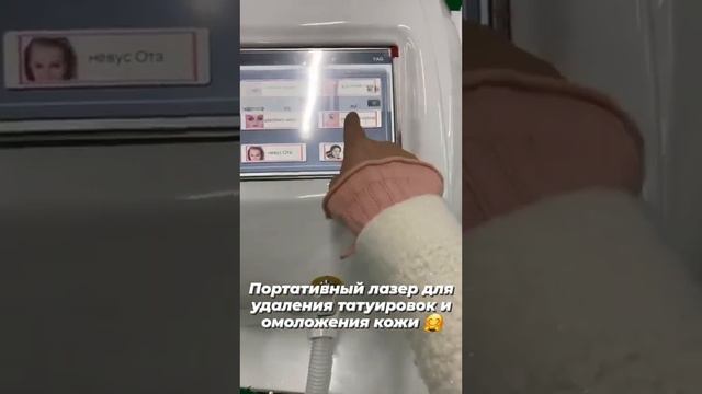 Портативный лазер для удаления тату