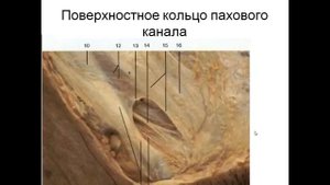 Топография передней брюшной стенки. Паховый канал