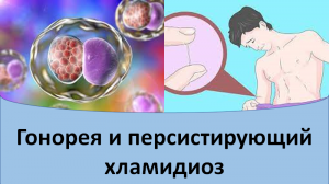 Гонорея и персистирующий хламидиоз