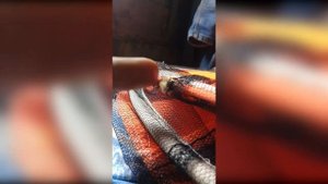 Укус шмеля, очень больно, срочно, шмель зомби откусил пол руки ))))