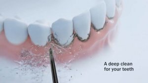 Achieve Better Dental Hygiene with the Insmart Oral Irrigator!