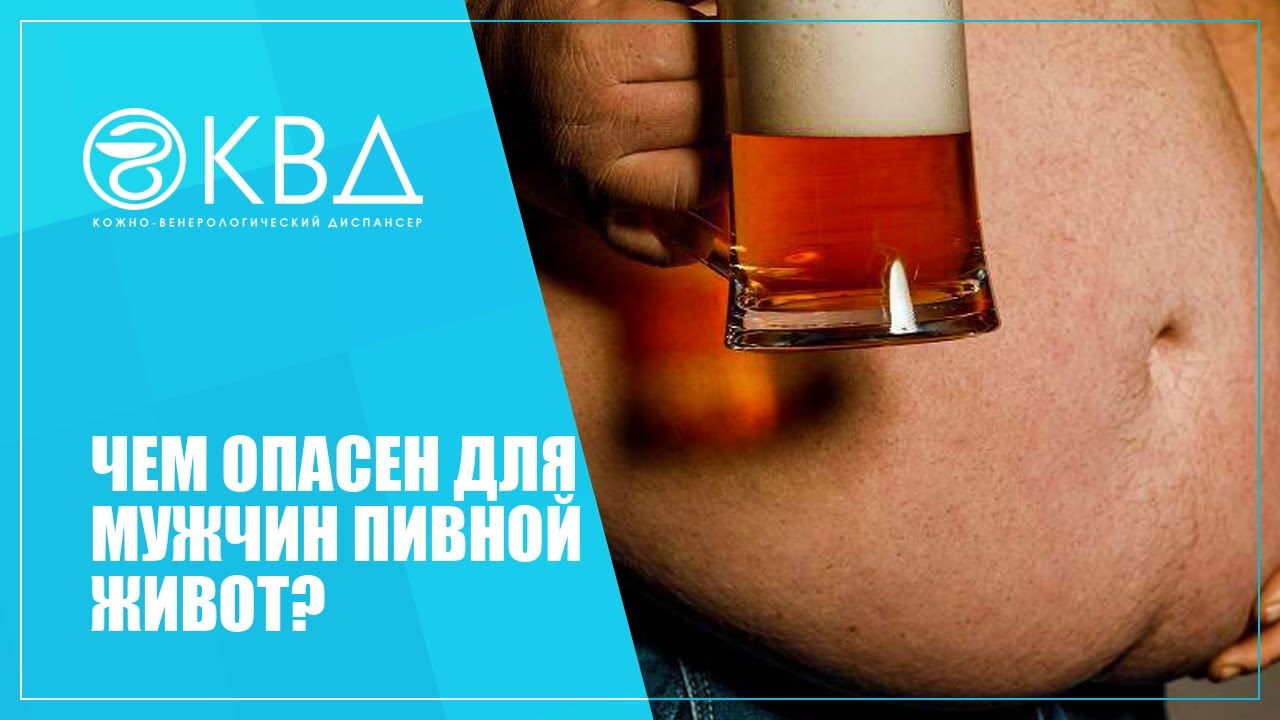 ? Чем опасен для мужчин пивной живот