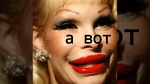 К чему приводит накаченные губы!?