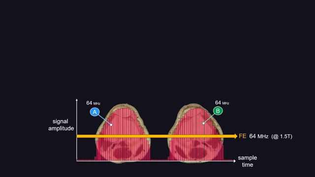Introduction to Clinical MRI Physics (part 2 of 3) смотреть онлайн