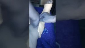 Как снимать гипс дома????