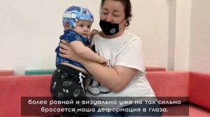 Ортопедический шлем Ортотис. Отзыв. История Иосифа