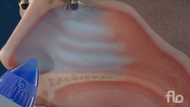 How Does Nasal & Sinus Irrigation Work - shortened version смотреть онлайн