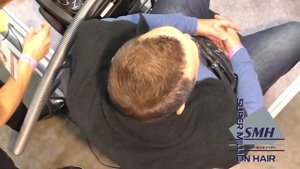 Залысины у мужчин и что с этим делать? Super Million Hair за 10 секунд скроет мужские залысины!