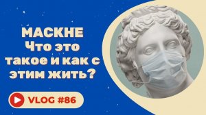 Маскне КАК ИЗБЕЖАТЬ? / КОНКУРС в видео!