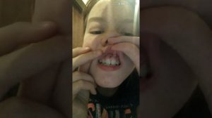 Vkey проколола смайл пирсинг сама дома? /почему? /как? ???❤️