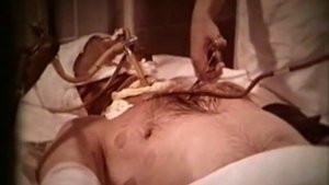 Искусственная вентиляция легких © Artificial ventilation of lungs