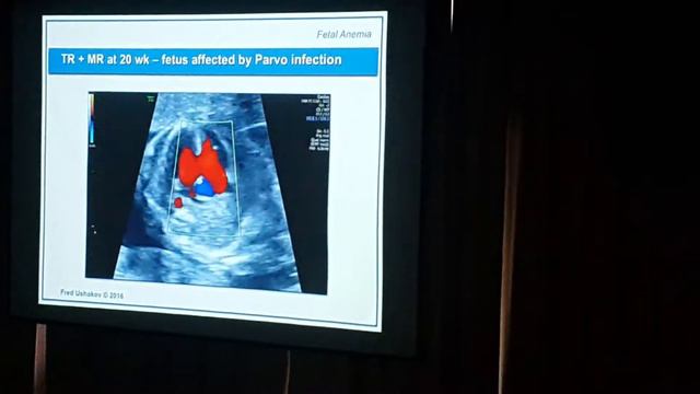 Анемия плода 2 часть смотреть онлайн