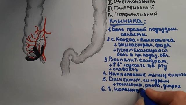 Аппендицит смотреть онлайн