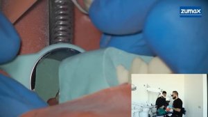 ПРЕПАРИРОВАНИЕ В ЗЕРКАЛО (ортопедическая стоматология)