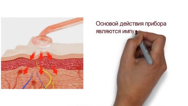 Аппарат Дарсонваль. Дудл ролик смотреть онлайн