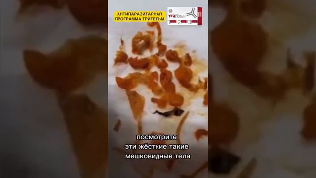 Жуткие монстры внутри нас. Видео не для слабонервных.