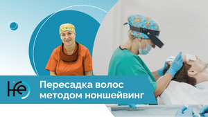 Пересадка волос методом ноншейвинг