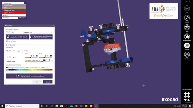Virtual Articulator -Dr. Adarve