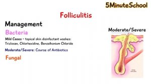 HOW TO TREAT FOLLICULITIS FAST