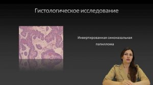 Инвертированная синоназальная папиллома. Рассказывает к. м. н. Марьям Зауровна Джафарова.