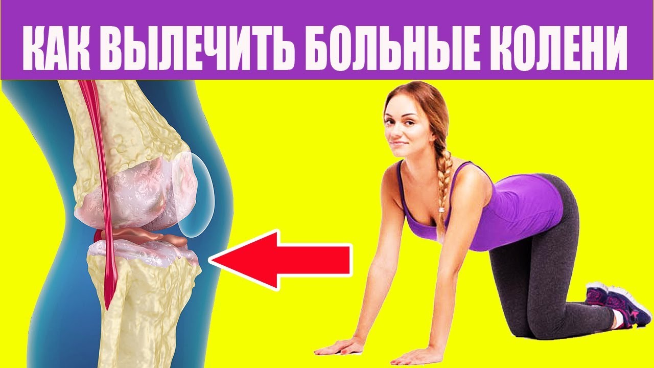 Если Болит Колено Помогут Упражнения Для Коленей