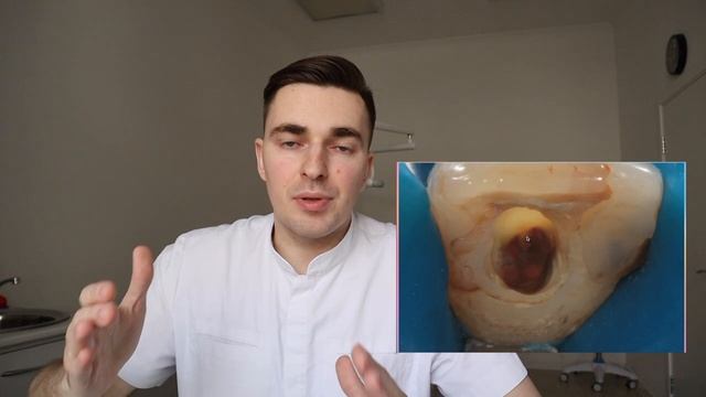 Зачем перелечивать зубы?