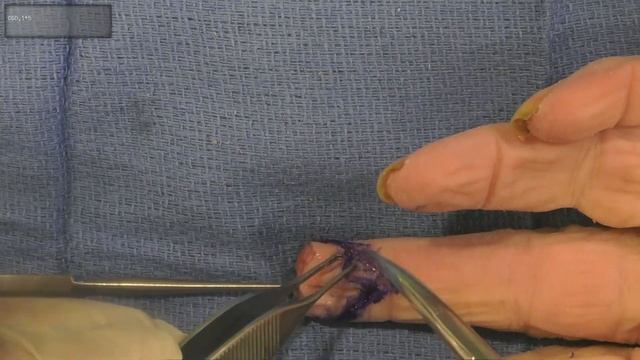 VY Flap смотреть онлайн