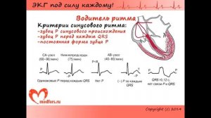 Урок 3. Видеокурс "ЭКГ под силу каждому".