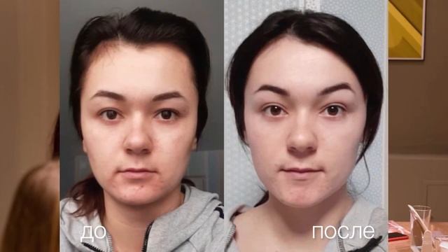Тренер по Фейсфитнесу. #фейсфитнес #фейсбилдинг #фейсбилдингдлялица #фейсйога #гимнастикадлялица