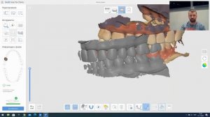 Серйозні можливості інтраорального  3D сканера Medit I500