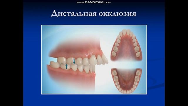 Основные методы лечения аномалий и деформаций