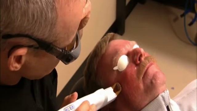 Cutera Excel V Başlığı ve Özellikleri ndyaglazer.net смотреть онлайн