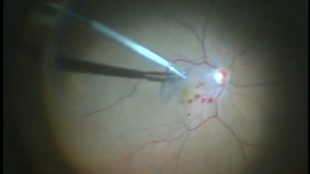 OptiFlex