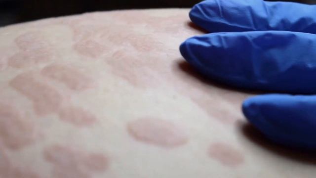 ЛАЗЕРНАЯ ШЛИФОВКА В LAZERINI смотреть онлайн