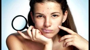 Как убрать родинки с лица