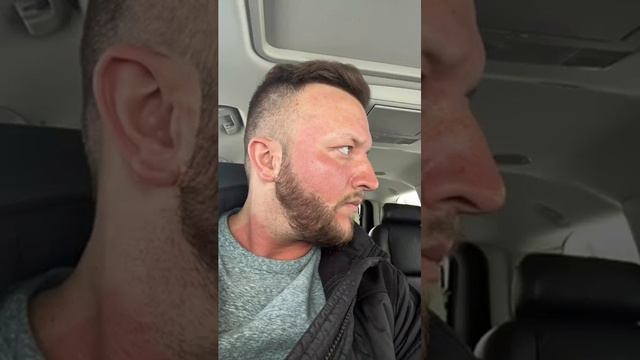Пересадка волос и бороды до⧸после