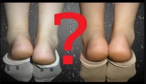 РАЗНАЯ ДЛИНА НОГ и разная высота ног
